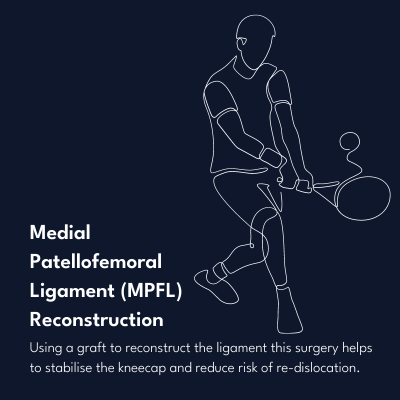 Medial Patellofemoral Ligament (mpfl) Reconstruction