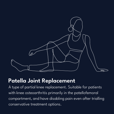 Patella Joint Replacement